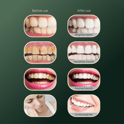 Dental Calculus Household Dental Scaler