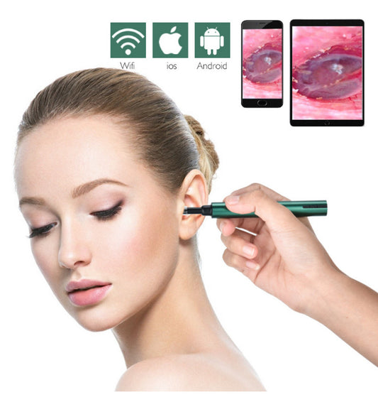 Wireless WiFi Visual Otoscope