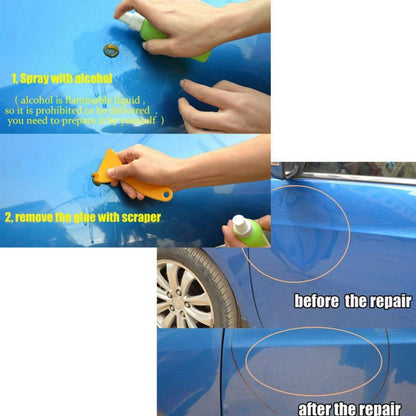 Dent Removal Kit